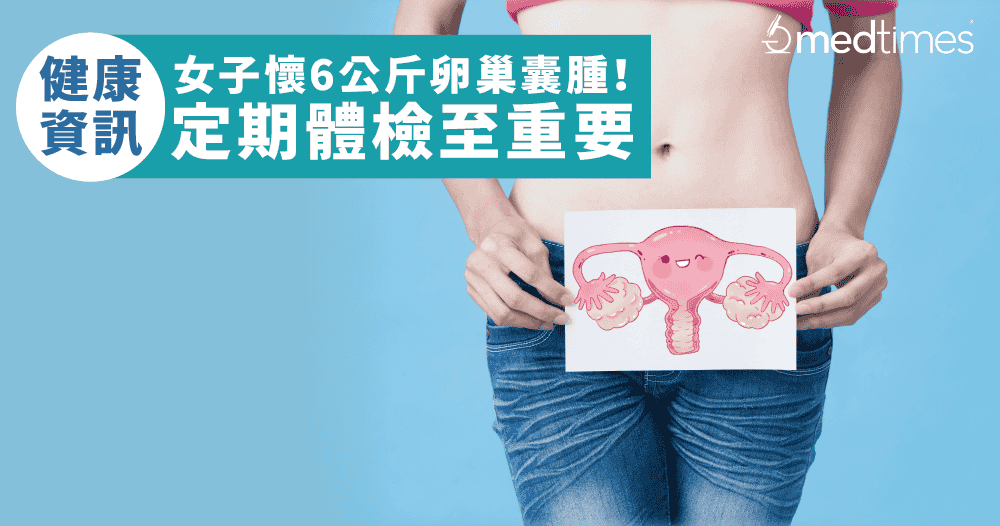 【健康資訊】女子懷6公斤卵巢囊腫！定期體檢至重要